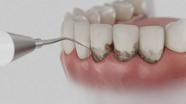 Reliable Dental Implants contractor in Bushnell, IL by Smile Center Dentistry